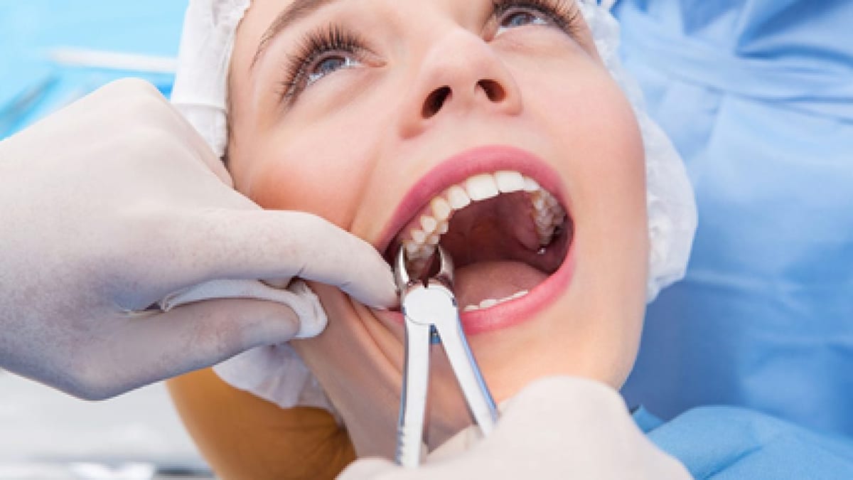 Extração e Cirurgia Oral na Sorriliê Clínica Odontológica em Senador Canedo