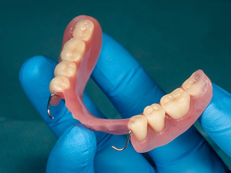 Prótese Dentária na Sorriliê Clínica Odontológica em Senador Canedo