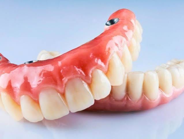 Protocolo dentário ou dentadura: qual a diferença na prática?